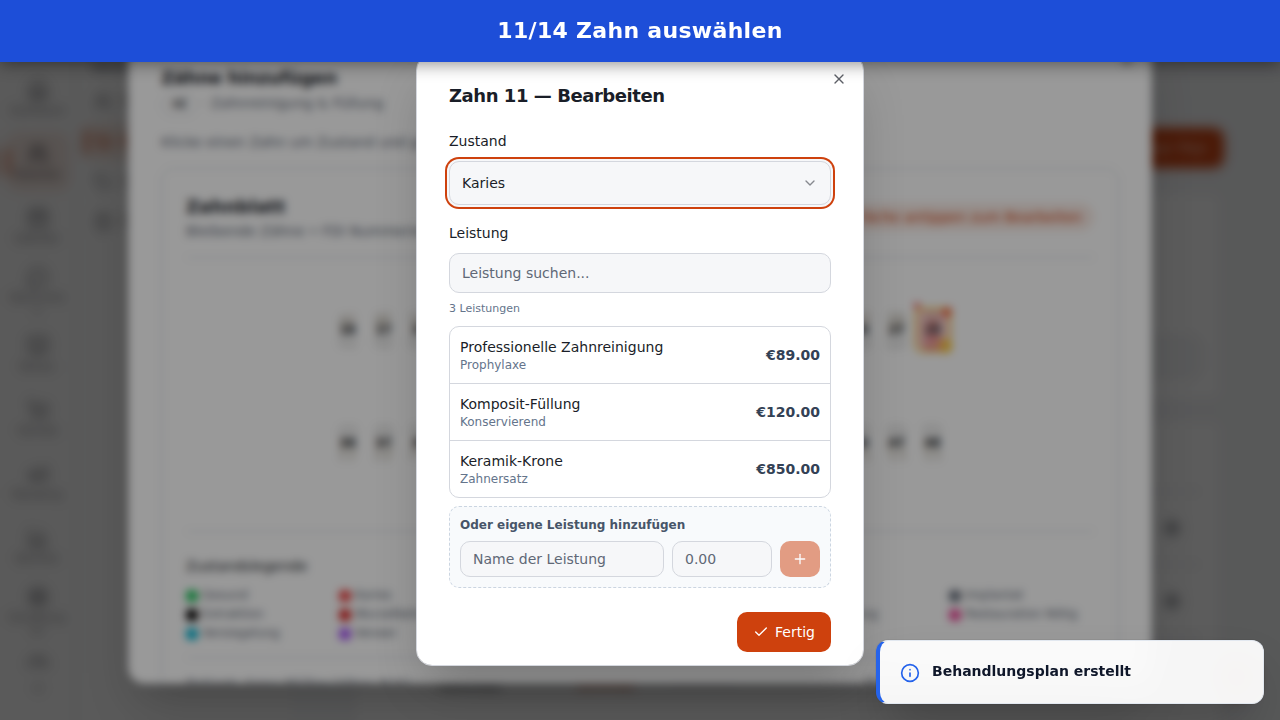Zahn auswählen