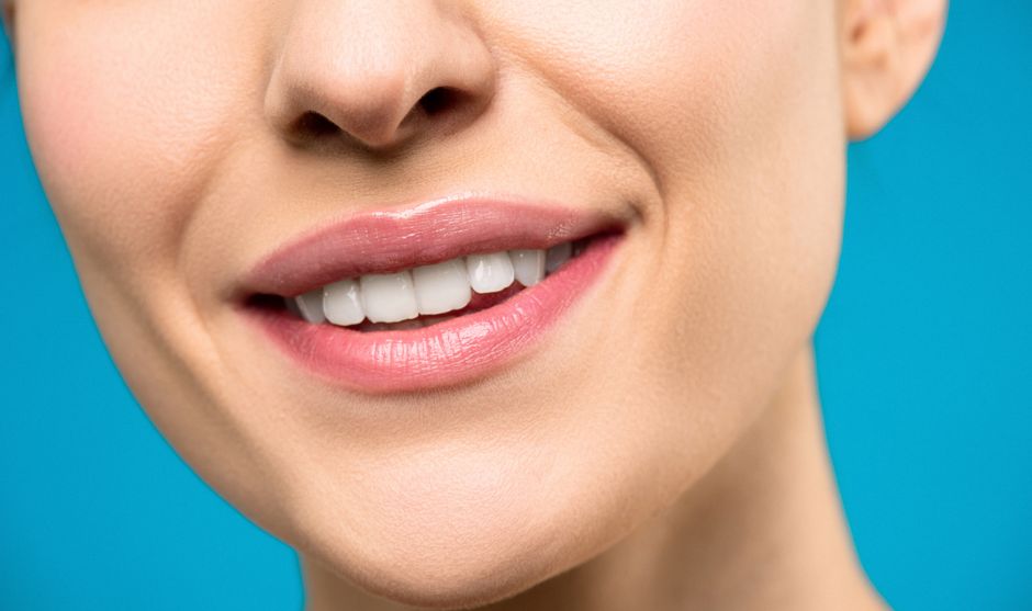 Veneers Haltbarkeit 2026: Wie lange halten Veneers wirklich?