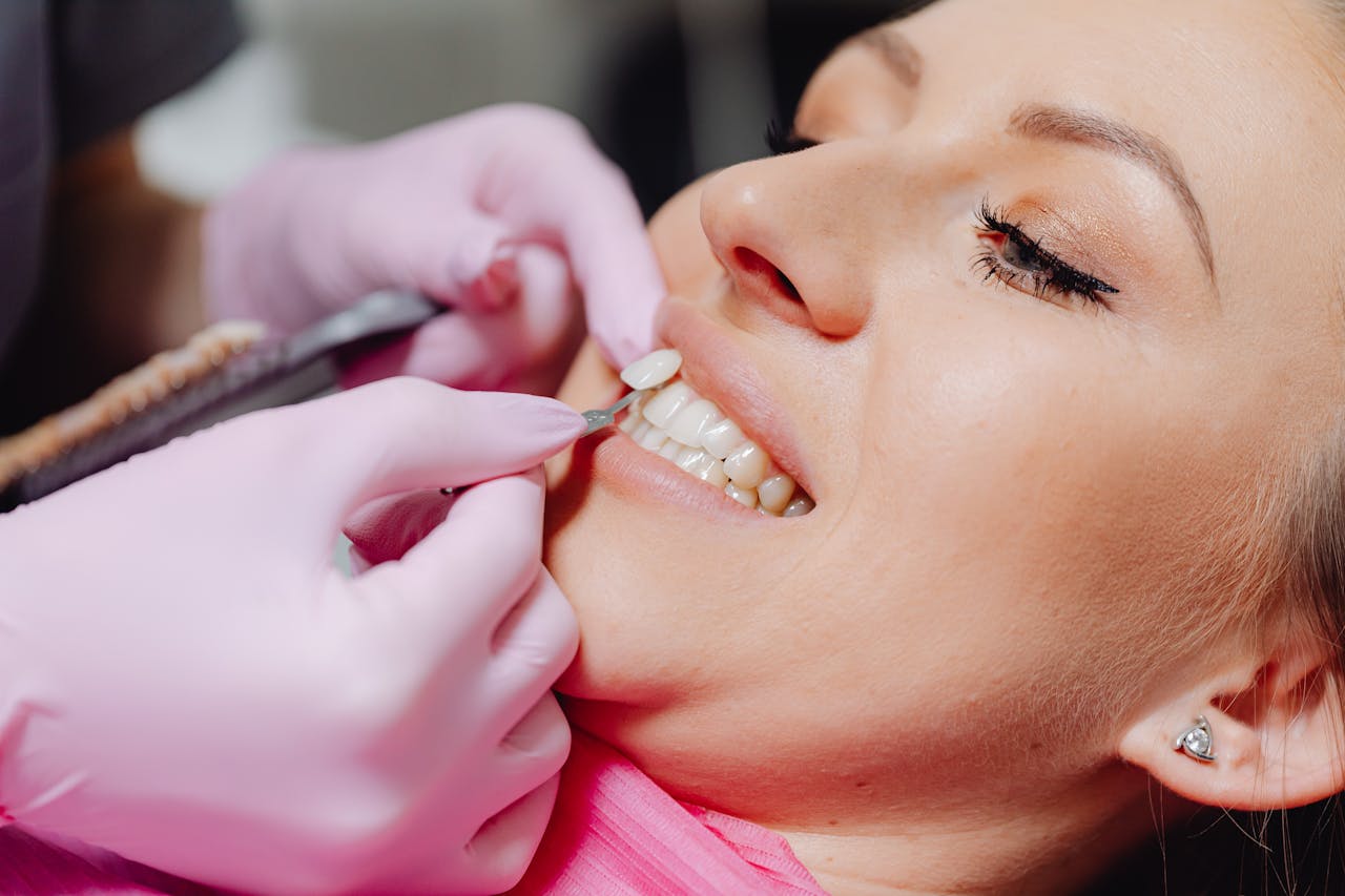 Veneers Haltbarkeit 2026