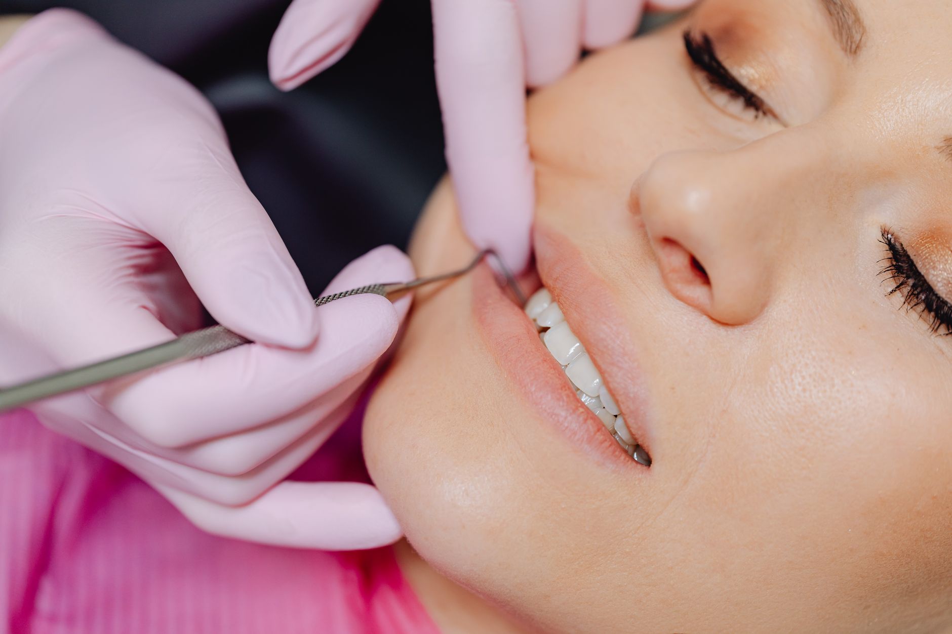 Dental Contouring: Wenn 15 Minuten beim Zahnarzt mehr bewirken als 2 Jahre Zahnspange